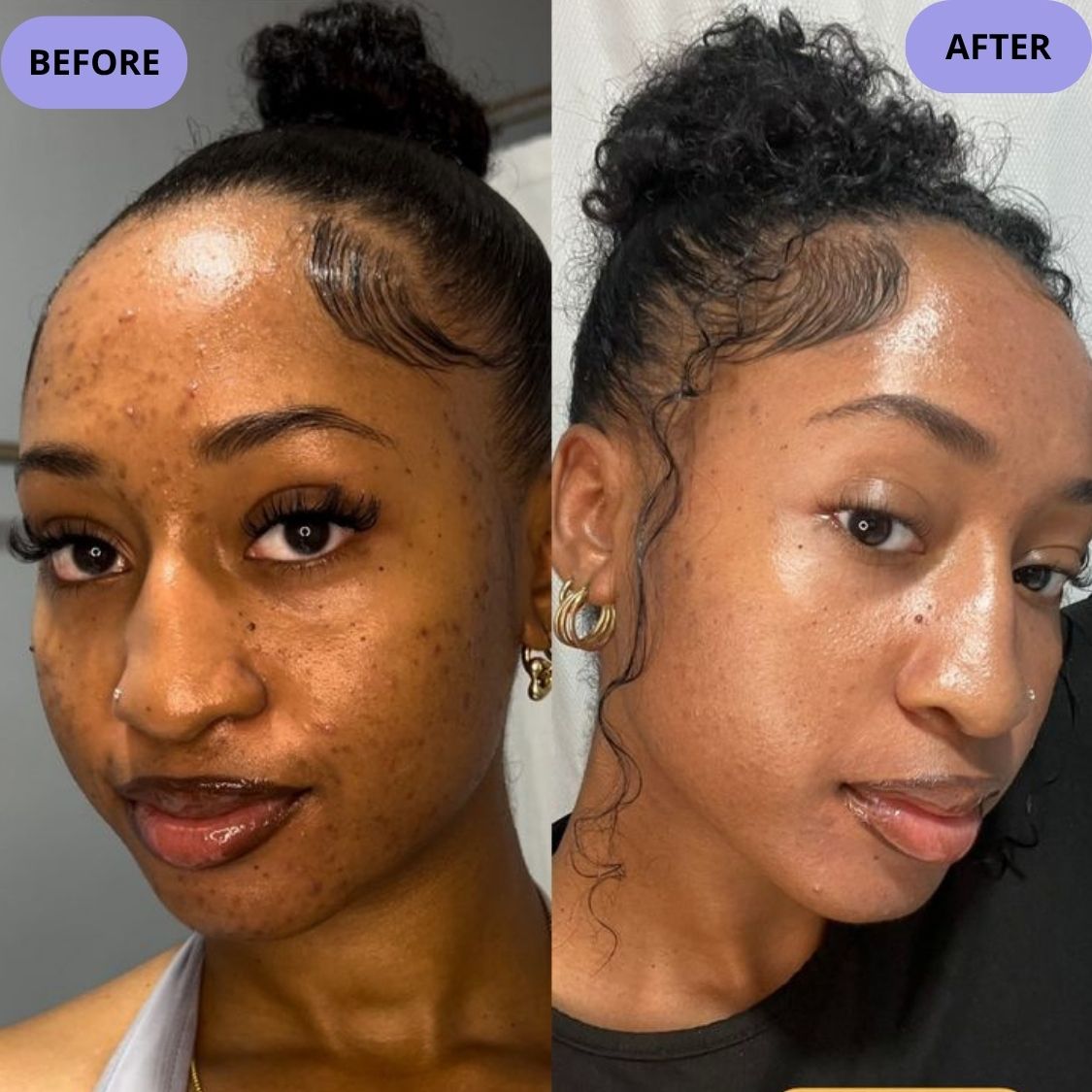 Dark Spot Serum for Normal Skin