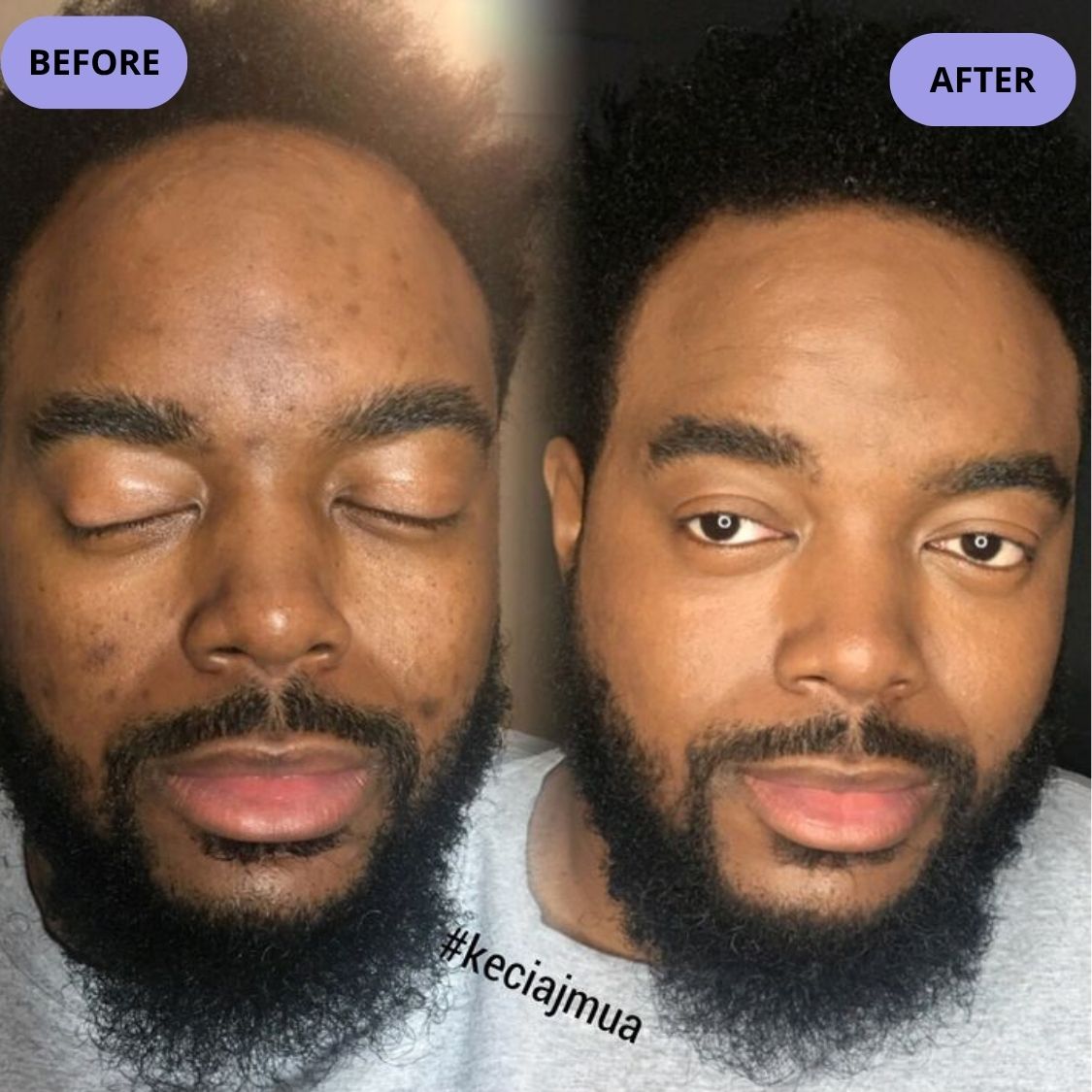 Dark Spot Serum for Normal Skin